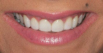Family, Cosmetic & Implant Dentist in Lexington, KY