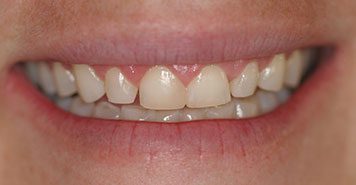Family, Cosmetic & Implant Dentist in Lexington, KY