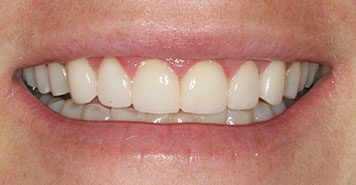 Family, Cosmetic & Implant Dentist in Lexington, KY