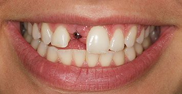 Family, Cosmetic & Implant Dentist in Lexington, KY