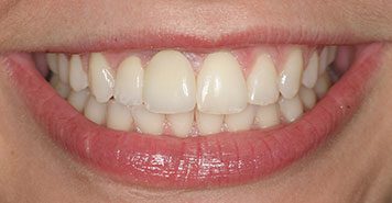 Family, Cosmetic & Implant Dentist in Lexington, KY
