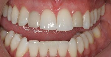 Family, Cosmetic & Implant Dentist in Lexington, KY