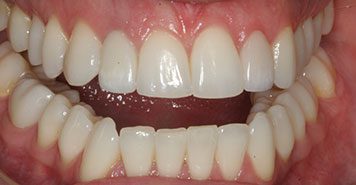 Family, Cosmetic & Implant Dentist in Lexington, KY