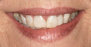 Family, Cosmetic & Implant Dentist in Lexington, KY