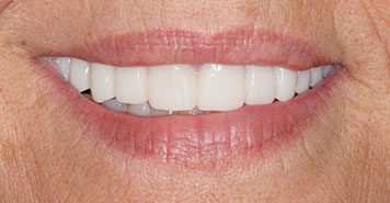 Family, Cosmetic & Implant Dentist in Lexington, KY