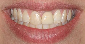 Family, Cosmetic & Implant Dentist in Lexington, KY