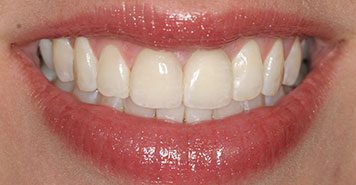 Family, Cosmetic & Implant Dentist in Lexington, KY