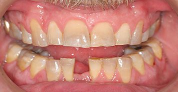 Family, Cosmetic & Implant Dentist in Lexington, KY