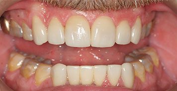 Family, Cosmetic & Implant Dentist in Lexington, KY
