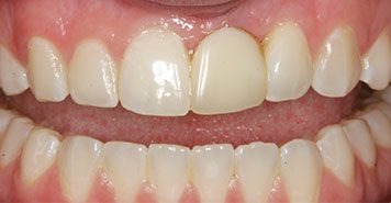 Family, Cosmetic & Implant Dentist in Lexington, KY