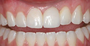 Family, Cosmetic & Implant Dentist in Lexington, KY