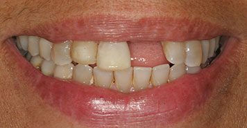 Family, Cosmetic & Implant Dentist in Lexington, KY