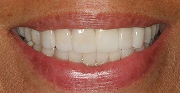 Family, Cosmetic & Implant Dentist in Lexington, KY
