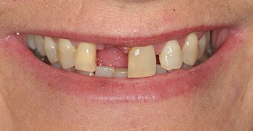 Family, Cosmetic & Implant Dentist in Lexington, KY