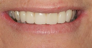 Family, Cosmetic & Implant Dentist in Lexington, KY