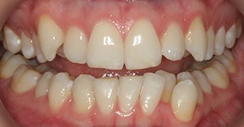 Family, Cosmetic & Implant Dentist in Lexington, KY