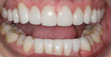 Family, Cosmetic & Implant Dentist in Lexington, KY