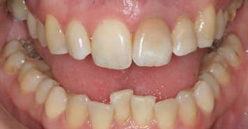 Family, Cosmetic & Implant Dentist in Lexington, KY