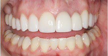 Family, Cosmetic & Implant Dentist in Lexington, KY