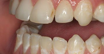 Family, Cosmetic & Implant Dentist in Lexington, KY