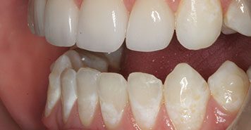 Family, Cosmetic & Implant Dentist in Lexington, KY