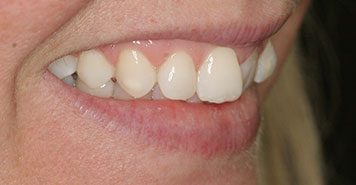 Family, Cosmetic & Implant Dentist in Lexington, KY