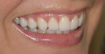 Family, Cosmetic & Implant Dentist in Lexington, KY