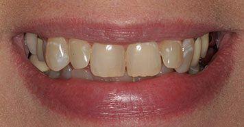 Family, Cosmetic & Implant Dentist in Lexington, KY