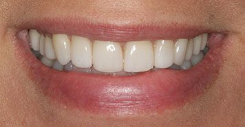 Family, Cosmetic & Implant Dentist in Lexington, KY