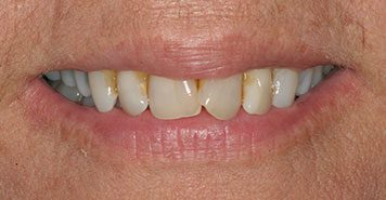 Family, Cosmetic & Implant Dentist in Lexington, KY