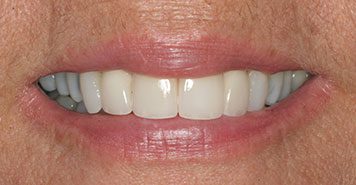 Family, Cosmetic & Implant Dentist in Lexington, KY