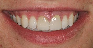 Family, Cosmetic & Implant Dentist in Lexington, KY