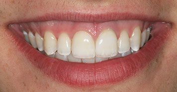 Family, Cosmetic & Implant Dentist in Lexington, KY