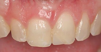 Family, Cosmetic & Implant Dentist in Lexington, KY