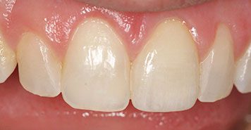 Family, Cosmetic & Implant Dentist in Lexington, KY