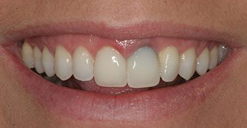 Family, Cosmetic & Implant Dentist in Lexington, KY