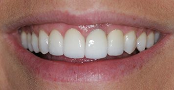 Family, Cosmetic & Implant Dentist in Lexington, KY