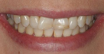 Family, Cosmetic & Implant Dentist in Lexington, KY