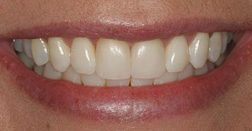 Family, Cosmetic & Implant Dentist in Lexington, KY