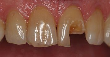 Family, Cosmetic & Implant Dentist in Lexington, KY