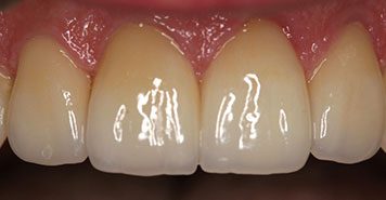 Family, Cosmetic & Implant Dentist in Lexington, KY