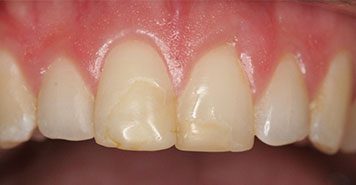 Family, Cosmetic & Implant Dentist in Lexington, KY