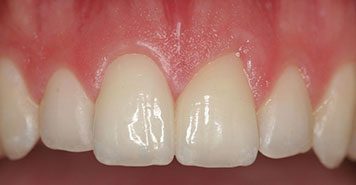 Family, Cosmetic & Implant Dentist in Lexington, KY