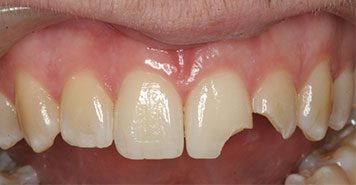 Family, Cosmetic & Implant Dentist in Lexington, KY