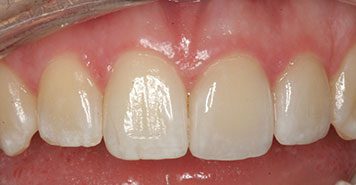 Family, Cosmetic & Implant Dentist in Lexington, KY