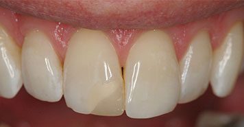 Family, Cosmetic & Implant Dentist in Lexington, KY