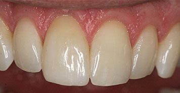 Family, Cosmetic & Implant Dentist in Lexington, KY