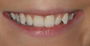 Family, Cosmetic & Implant Dentist in Lexington, KY