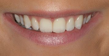 Family, Cosmetic & Implant Dentist in Lexington, KY