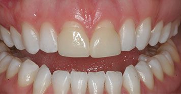 Family, Cosmetic & Implant Dentist in Lexington, KY